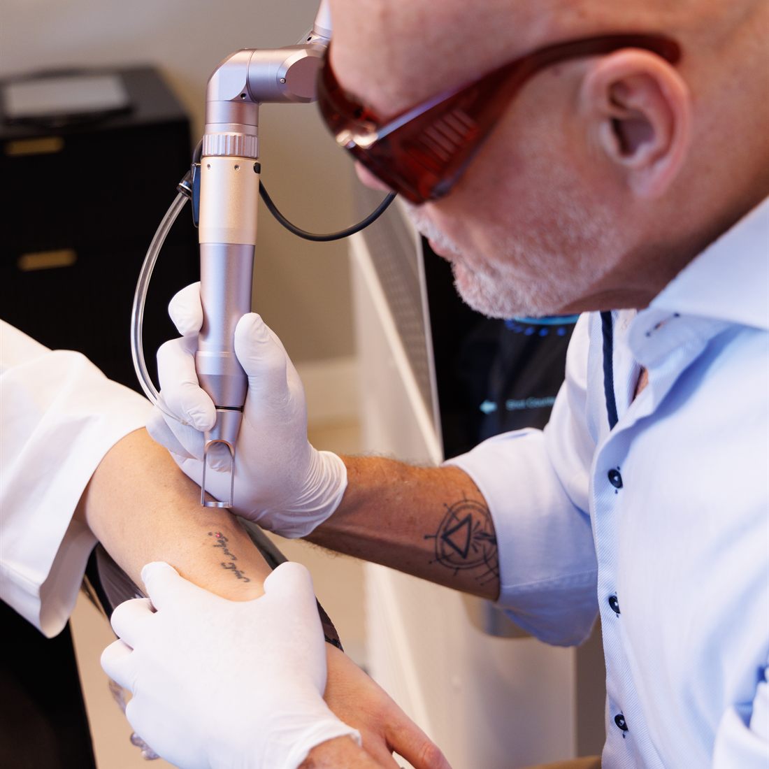Picosecond-laserapparatuur voor tattoo verwijdering