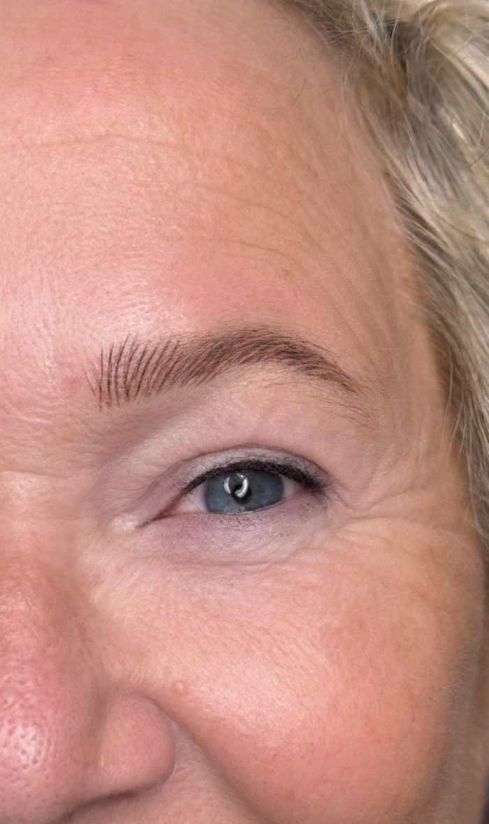 Genezen nano-hairstroke wenkbrauw bij een cli&euml;nt van MHP Centrum
