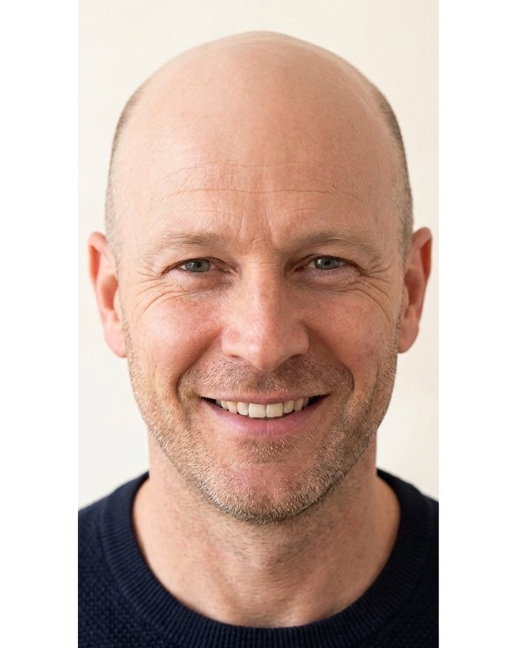 Hoofdhuid voor scalp micropigmentatie